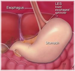 Lower Esophageal Sphincter Image